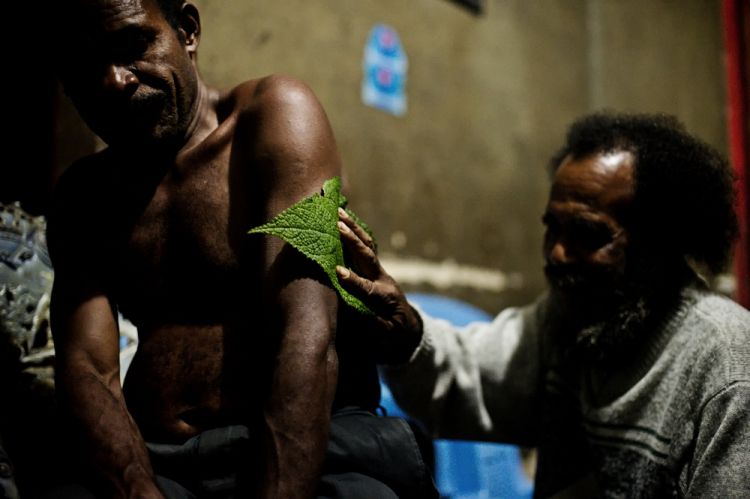 A Mooi man applies a medicinal plant to a man suffering with malaria