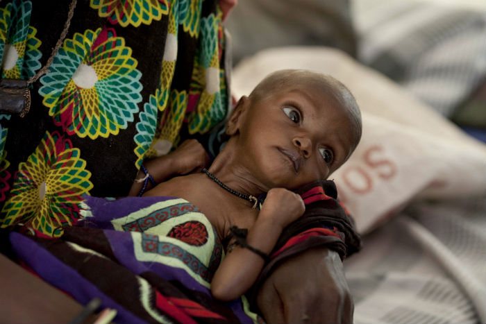 Isniino (30) at an MSF Malnutrition Centre with her baby Nastcho