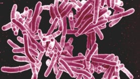Researchers develop new test to detect TB in children