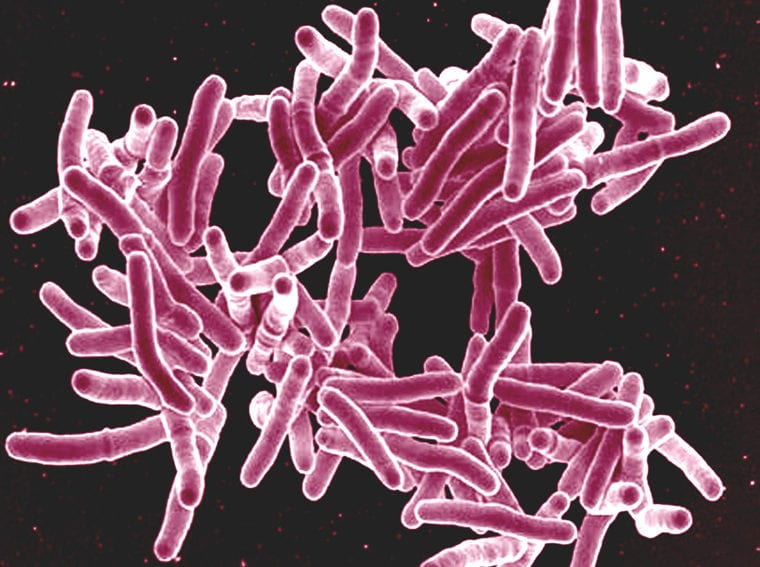 Mycobaterium tuberculosis