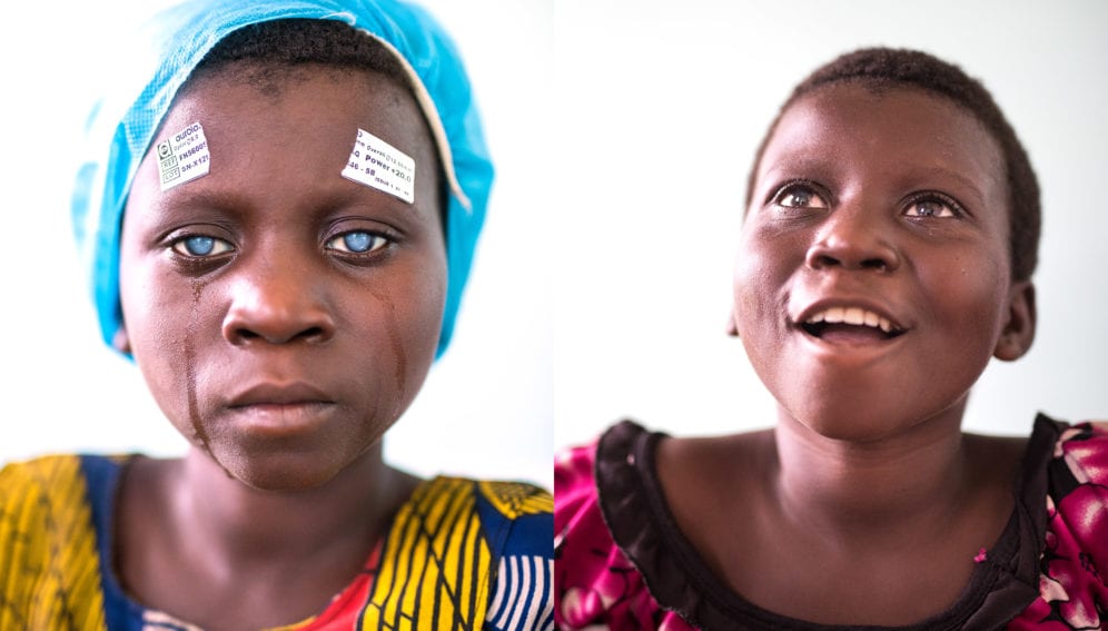 Cataract For twenty years, in the heart of Africa
