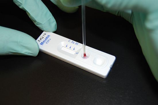 Rapid Diagnostic Test for Malaria