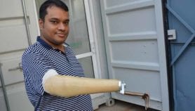 Prosthetics designers harness AI to assist India’s amputees
