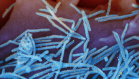 Respiratory virus ‘kills 100,000 children under five’