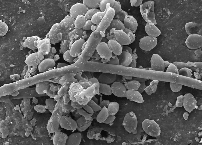 Fungal spores can be seen along a crack in a microplastic particle.
