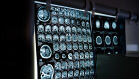 Why Africa should embrace brain science