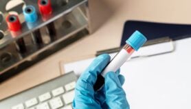 New blood test speeds childhood cancer diagnosis