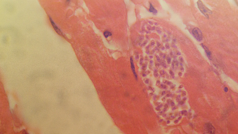 A microscope image of a section of infected mammal cardiac muscle. The parasite enters a cell and then multiplies, forming what is called a pseudocyst (seen on the right). This comprises up to 400 parasites in a single cell. Eventually, the cells rupture, releasing parasites into the bloodstream
