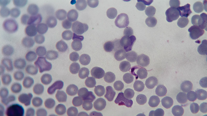 This microscope image shows the parasite (the purplish, sickle-shaped object towards the right amid round red blood cells) at another stage of development. At this trypomastigote stage, it moves through the blood to find other cells to penetrate and then form a new pseudocyst
