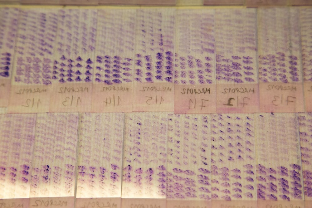 Rows of slides of smears from mouse liver and spleen. The slides are used to determine the extent of visceral leishmaniasis infection&nbsp;
