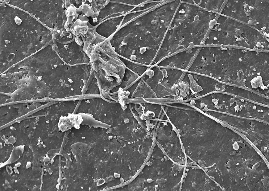 Fungal infestation of the soil.
