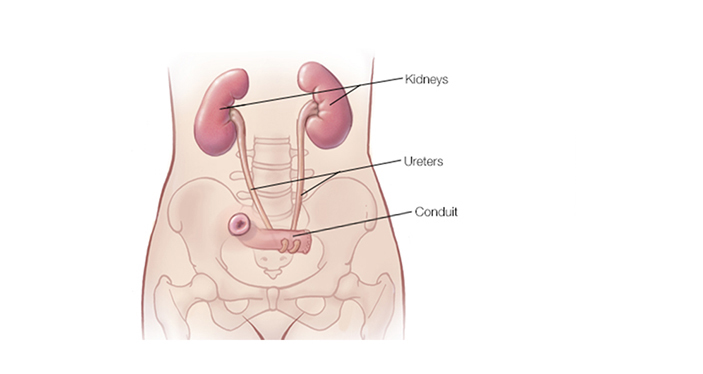 Kidneys 2