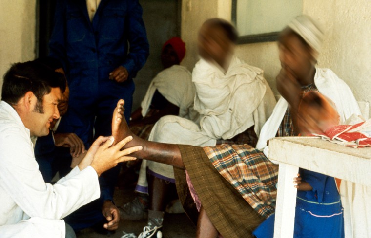examen clinico The Leprosy Mission International